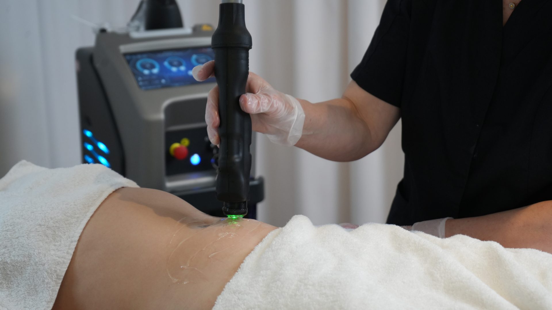 Laser-Behandlung Intim