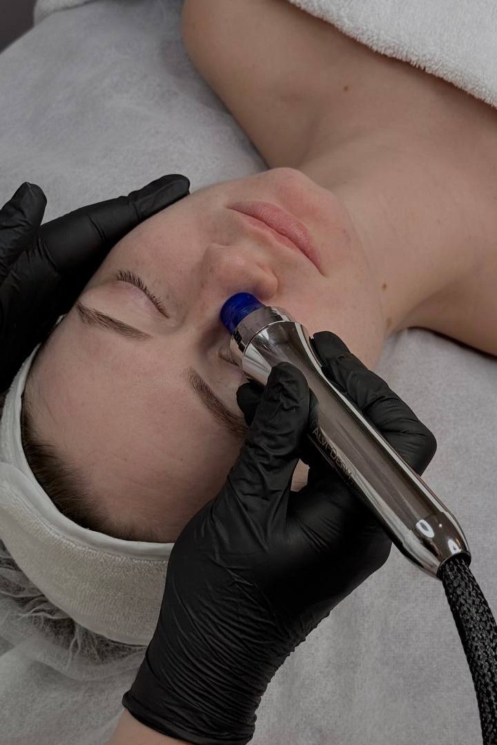 Mikrodermabrasion + Booster + Alginatmaske