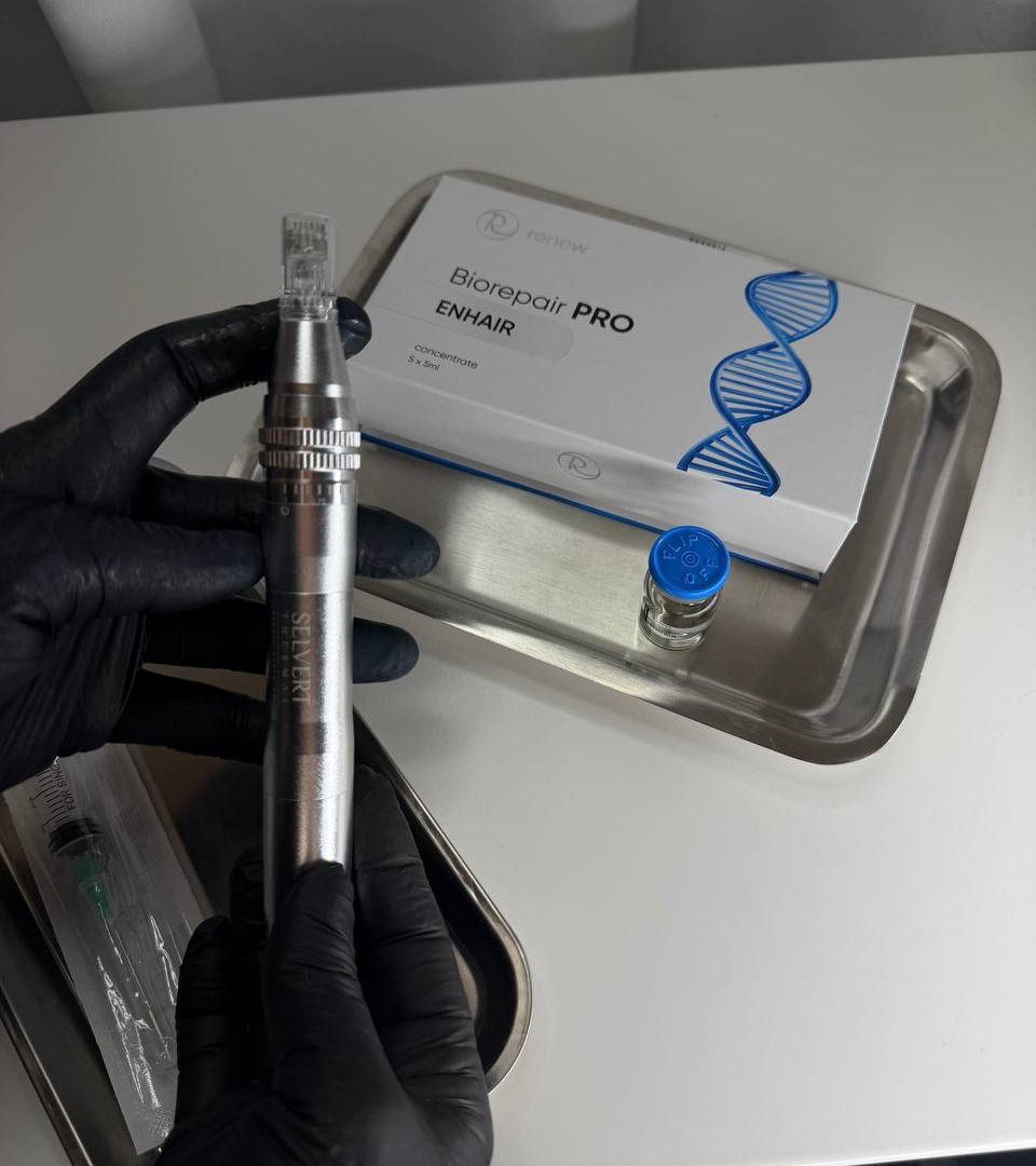 Haarmesotherapie mit Derma Pen